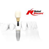 Импланты Nobel Biocare - знаменитые импланты из Швейцарии
