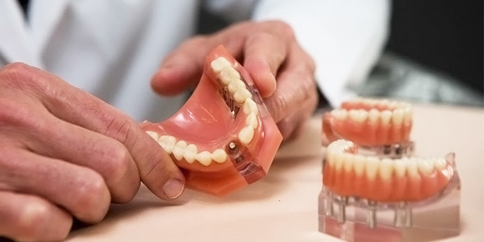 На фото — изготовление и установка несъемного зубного протеза