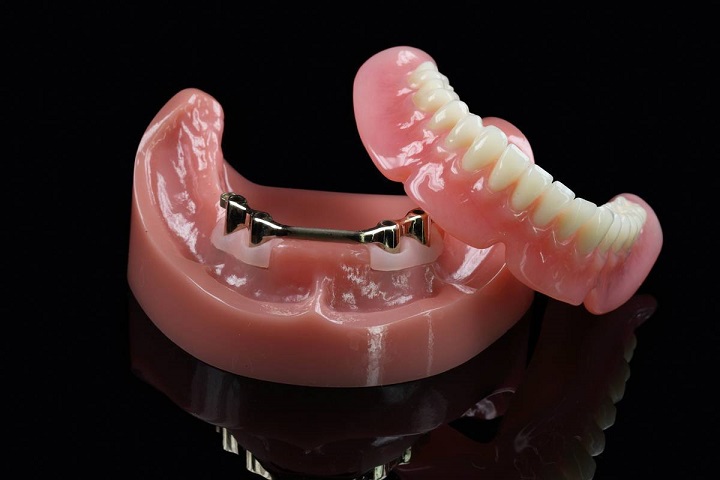 Условно-съемные протезы зубов